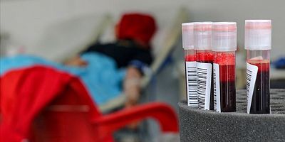 MHP’yi Usta’dan kan bağışı çağrısı